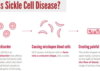 Know The Sickle Cell Disease