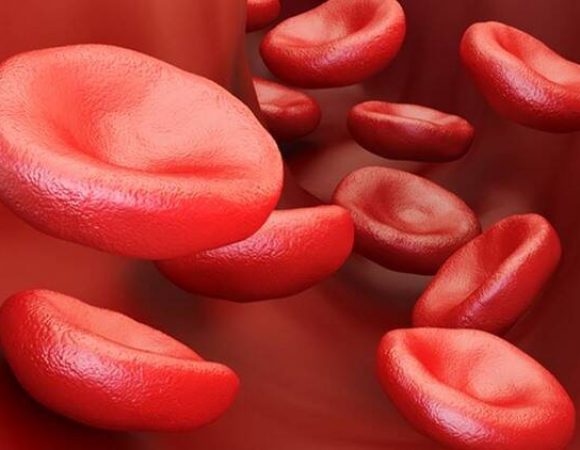 Sickle Cells