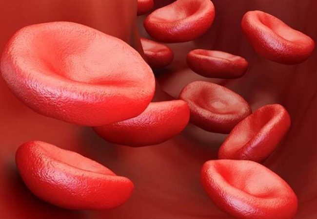 Sickle Cells